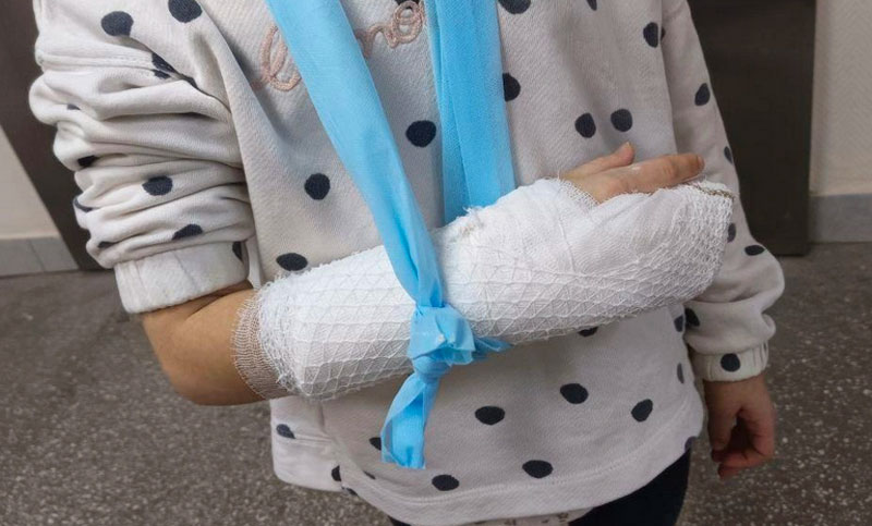 «Сказали, что ушиб»: в Екатеринбурге девочке не сразу выявили перелом | В Екатеринбурге врачи не выявили перелом со смещением у ребёнка